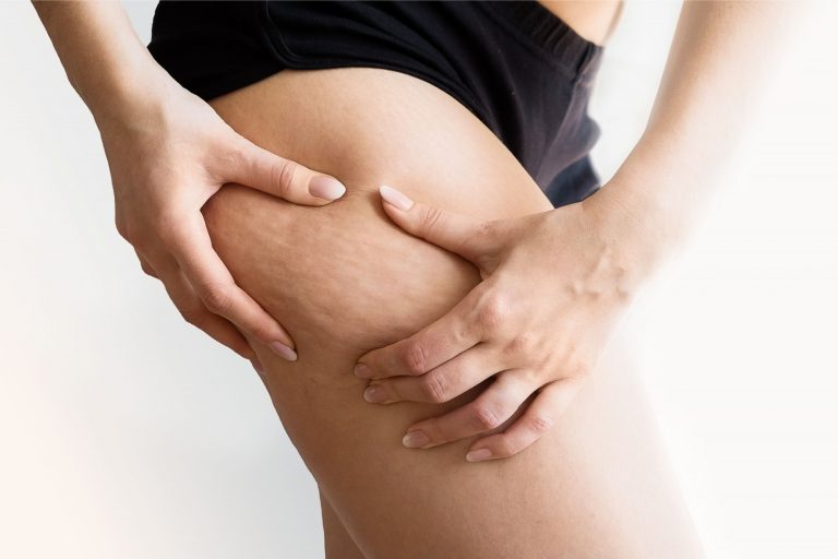 Hidrolipoclasia